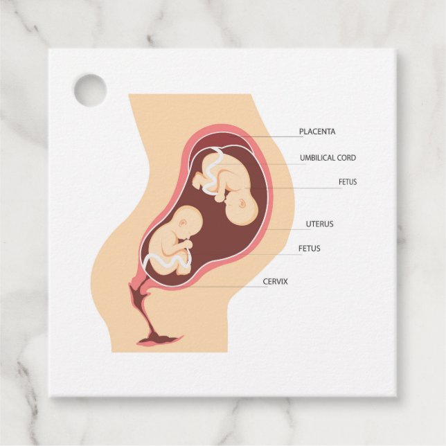 Dizygotisk tvillinggravid gåvor etiketter (Framsida)