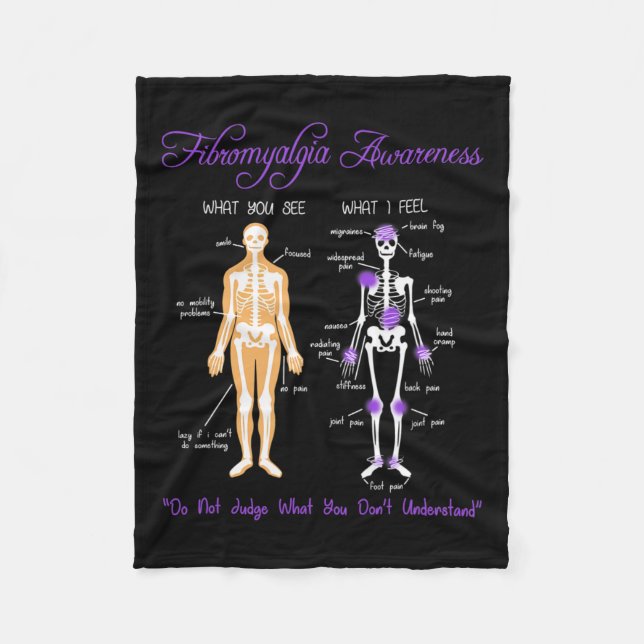 Du ser vad jag känner Skeleton Fibromyalgia Awaren Fleecefilt (Framsidan)