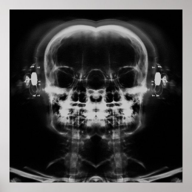 Dubbla X-Ray-Döskallar med hörlurar - B&W Poster (Framsidan)