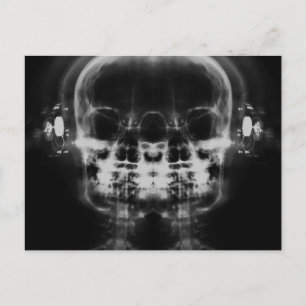 Dubbla X-Ray-Döskallar med hörlurar - B&W Vykort