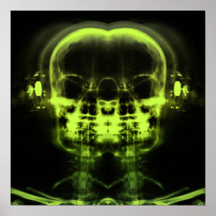 Dubbla X-Ray-Döskallar med hörlurar - limma grön Poster