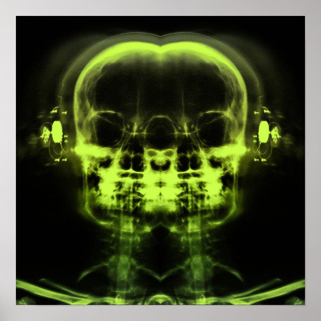 Dubbla X-Ray-Döskallar med hörlurar - limma grön Poster (Framsidan)