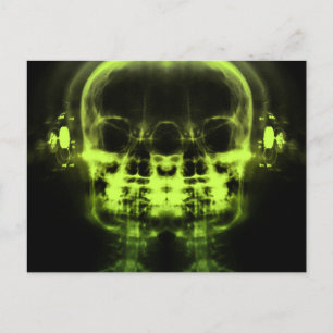 Dubbla X-Ray-Döskallar med hörlurar - limma grön Vykort