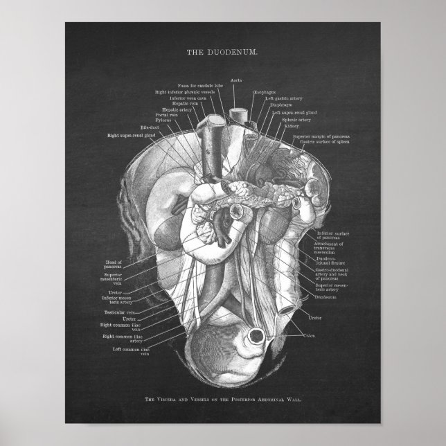 Duodenum Anatomy Art Gastroenterolog Wall Decor Poster (Framsidan)