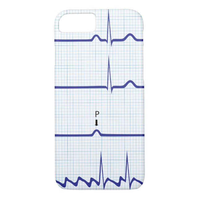 ECG-/EKGiphone case Case-Mate iPhone Skal (Baksida)