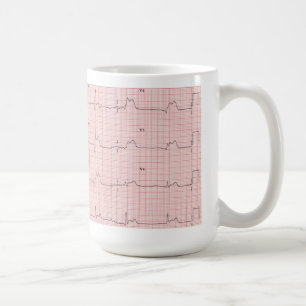 ECG-mugg Kaffemugg