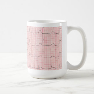 ECG-mugg Kaffemugg
