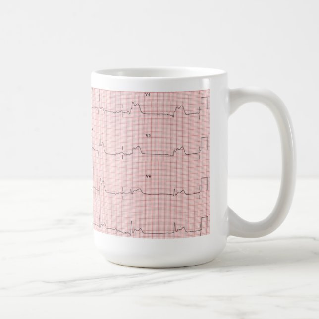 ECG-mugg Kaffemugg (Höger)