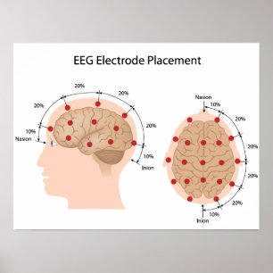 EEG-elektrodplaceringsdiagram Poster