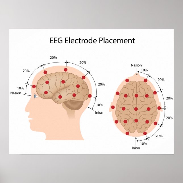 EEG-elektrodplaceringsdiagram Poster (Framsidan)