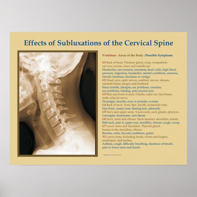 Effekter av cervikal spinalsubluxation Poster (Framsidan)