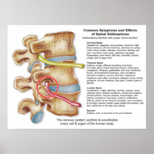 Effekter av spinalsubluxation Chiropraktik Poster