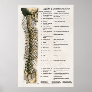 Effekter av spinalsubluxation Poster frossa