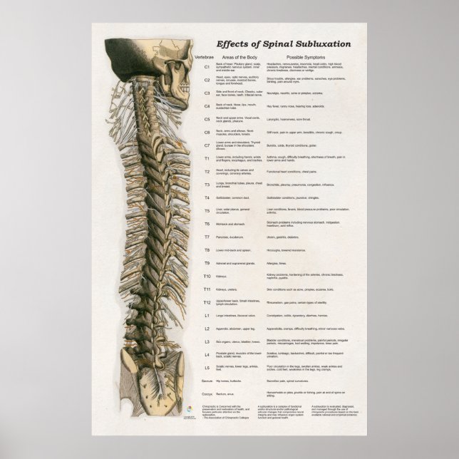 Effekter av spinalsubluxation Poster frossa (Framsidan)