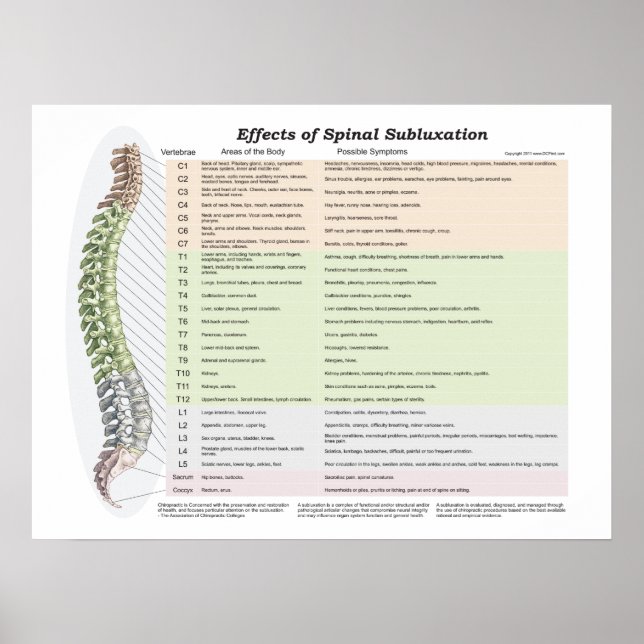 Effekter av spinalsubluxation Poster frossa (Framsidan)
