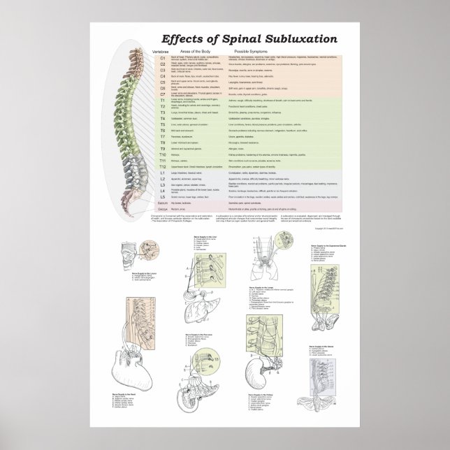 Effekter av spinalsubluxation Poster frossa (Framsidan)