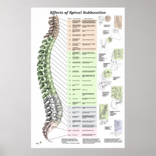 Effekter av spinalsubluxation Poster frossa