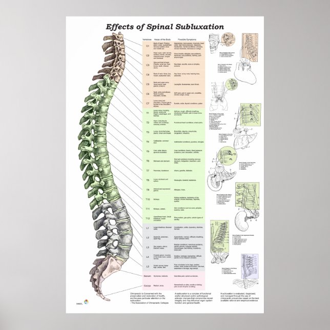 Effekter av spinalsubluxation Poster frossa (Framsidan)