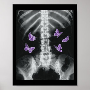 Egirl Xray Skeleton Rosa Butterfly Harajuku Y2k Da Poster