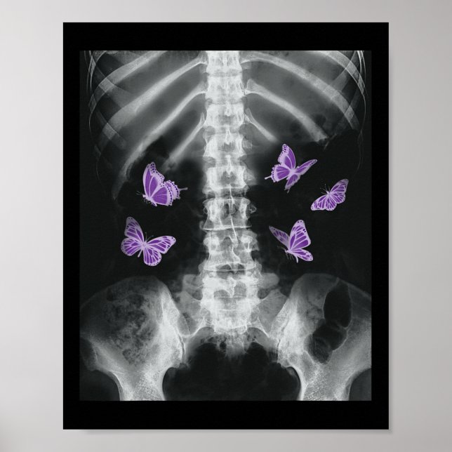 Egirl Xray Skeleton Rosa Butterfly Harajuku Y2k Da Poster (Framsidan)