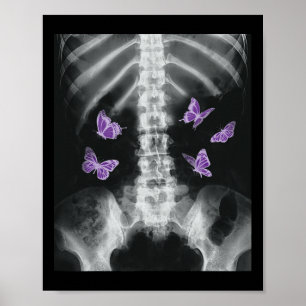 Egirl Xray Skeleton Rosa Butterfly Harajuku Y2k Da Poster