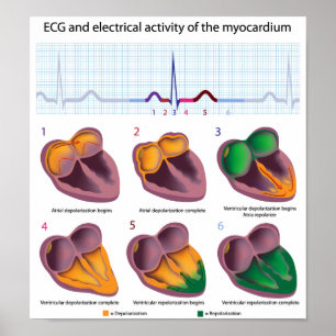 EKG-Poster elektrisk aktivitet i hjärtat Poster