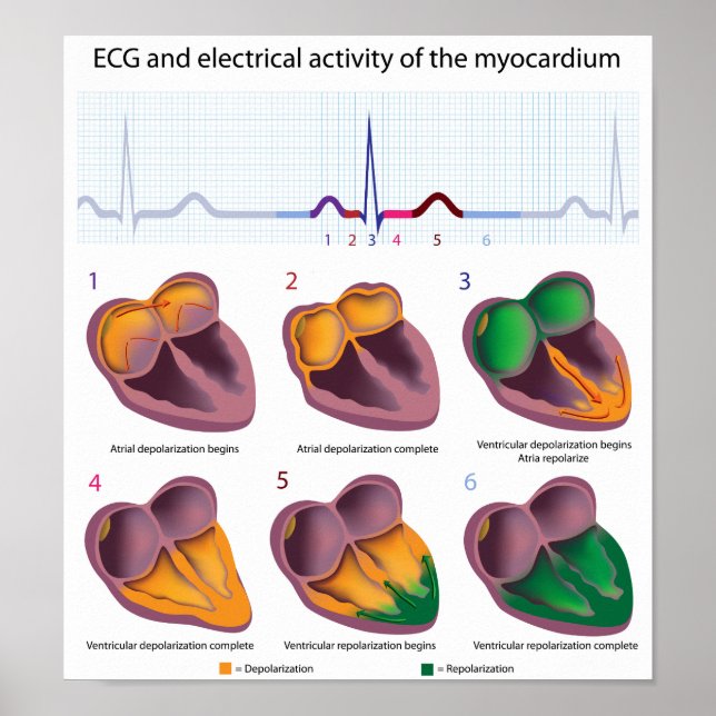 EKG-Poster elektrisk aktivitet i hjärtat Poster (Framsidan)