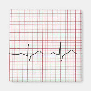 EKG-pulsslag på diagrammet pappert, PhD-puls (dok Magnet