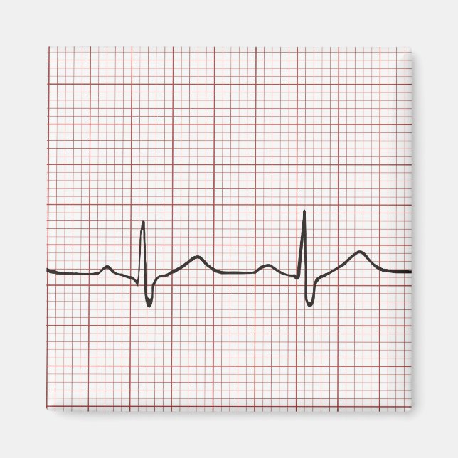 EKG-pulsslag på diagrammet pappert, PhD-puls (dokt Magnet (Framsidan)