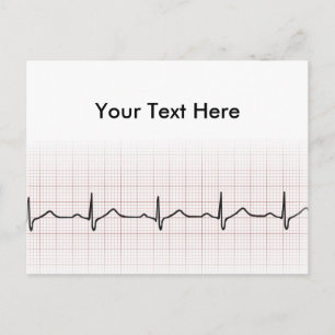 EKG-pulsslag på diagrammet pappert, PhD-puls (dokt Vykort