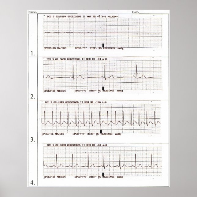 ekg Rhythms Poster (Framsidan)