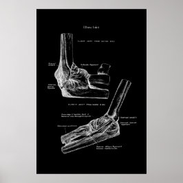 Elbow Joint Orthopedic Wall Decor Poster