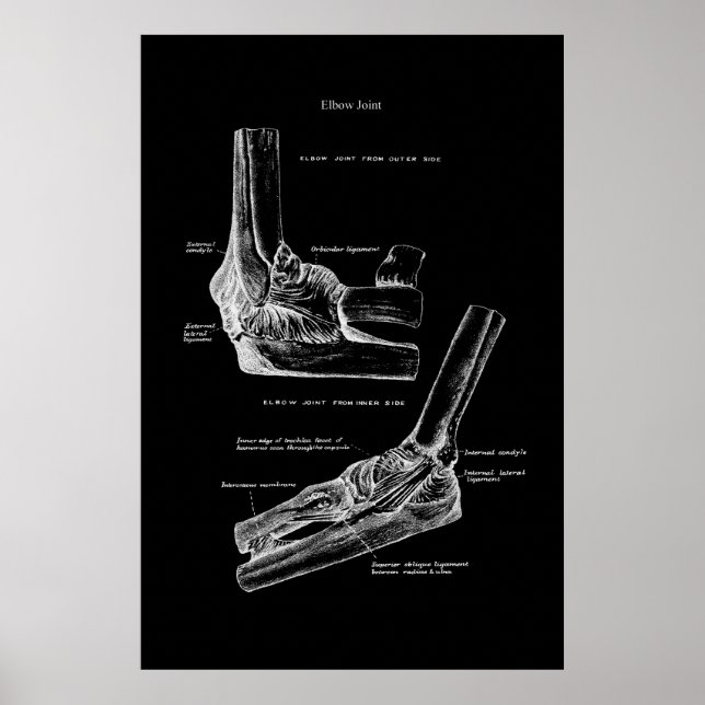 Elbow Joint Orthopedic Wall Decor Poster (Framsidan)