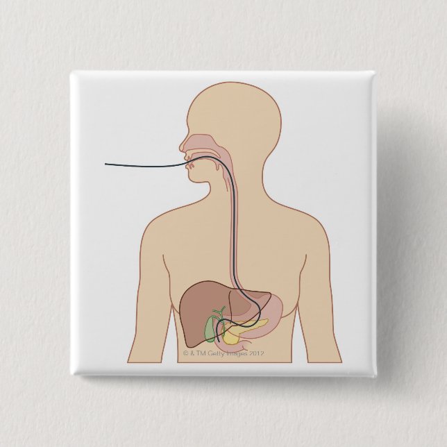 Endoskopets väg knapp (Framsida)