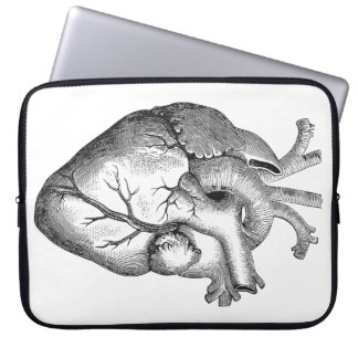 Enkel svart illustration för vitanatomihjärta laptop fodral