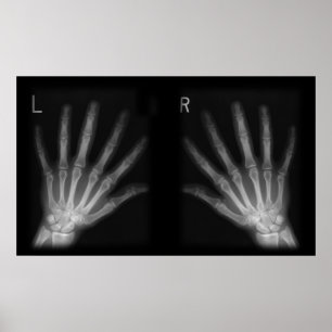 Extra Digit X-Höger och Lämnat Händer Poster