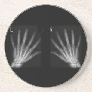 Extra Digit X-Höger och Lämnat Händer Underlägg Sandsten