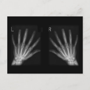 Extra Digit X-Höger och Lämnat Händer Vykort