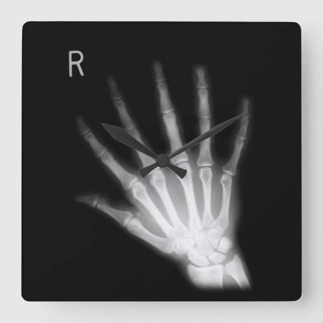 Extra Digit X-ray Höger Hand Fyrkantig Klocka (Framsida)