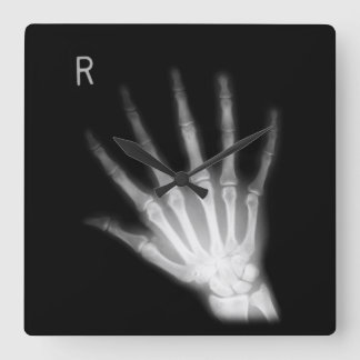 Extra Digit X-ray Höger Hand Fyrkantig Klocka