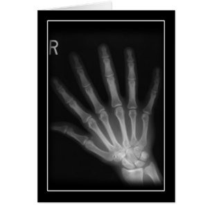 Extra Digit X-ray Höger Hand Hälsningskort
