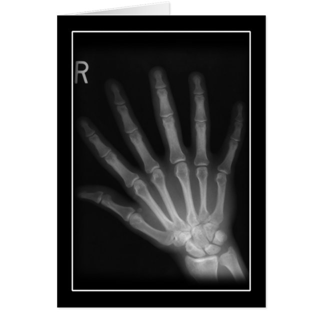 Extra Digit X-ray Höger Hand Hälsningskort (Framsidan)