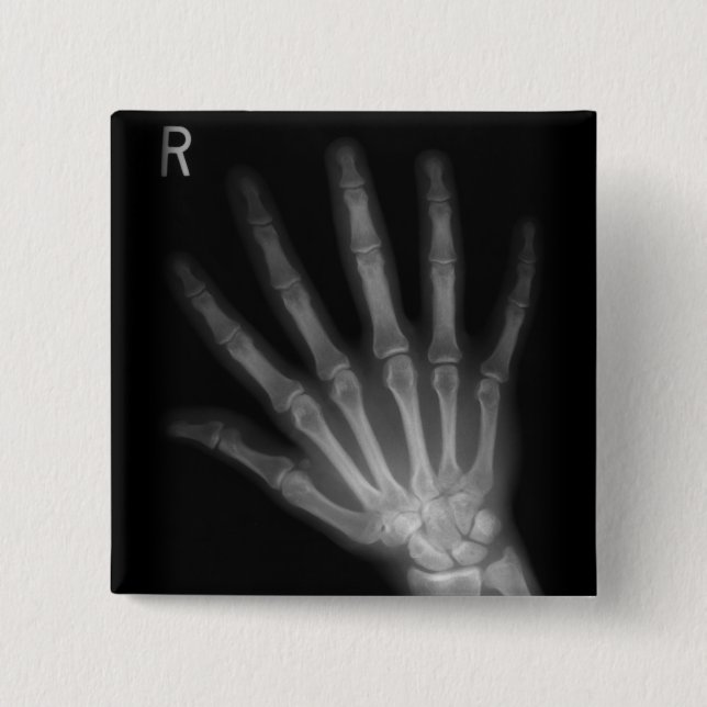 Extra Digit X-ray Höger Hand Knapp (Framsida)