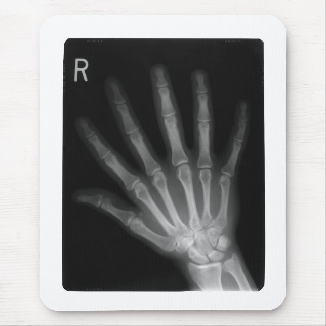 Extra Digit X-ray Höger Hand Musmatta (Framsidan)