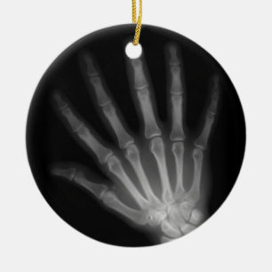 Extra Digit X-ray Lämnat hand Julgransprydnad Keramik