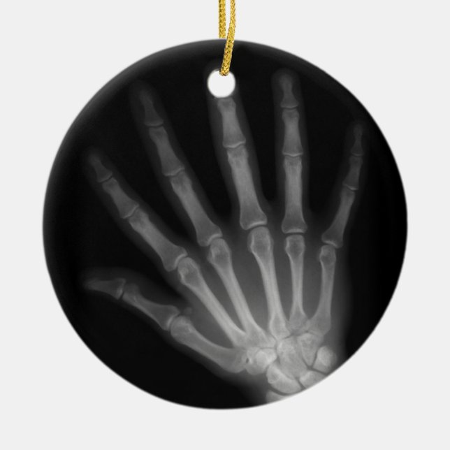 Extra Digit X-ray Lämnat hand Julgransprydnad Keramik (Framsidan)