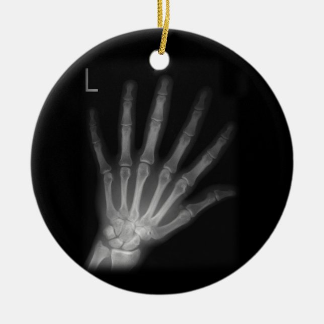 Extra Digit X-ray Lämnat hand Julgransprydnad Keramik (Framsidan)