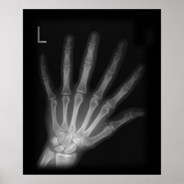 Extra Digit X-ray Lämnat hand Poster (Framsidan)