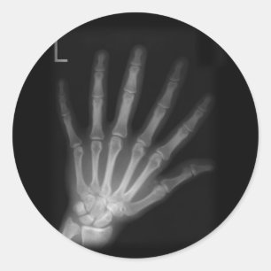 Extra Digit X-ray Lämnat hand Runt Klistermärke