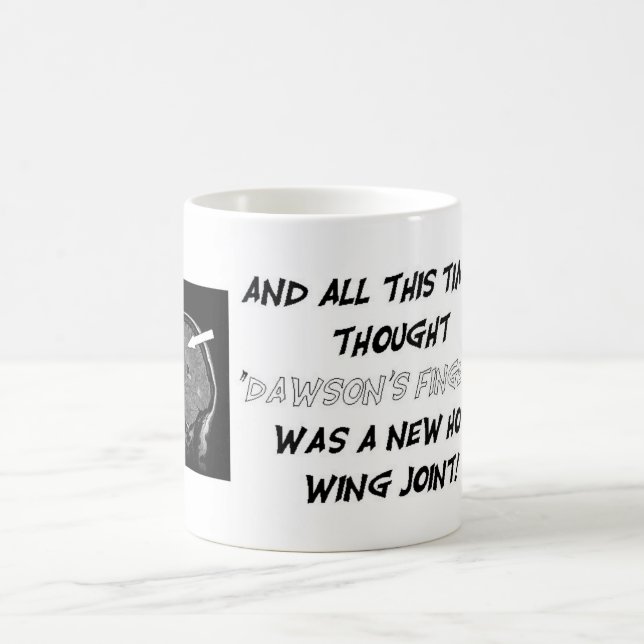 Få personlig med din organskada laddar! kaffemugg (Center)